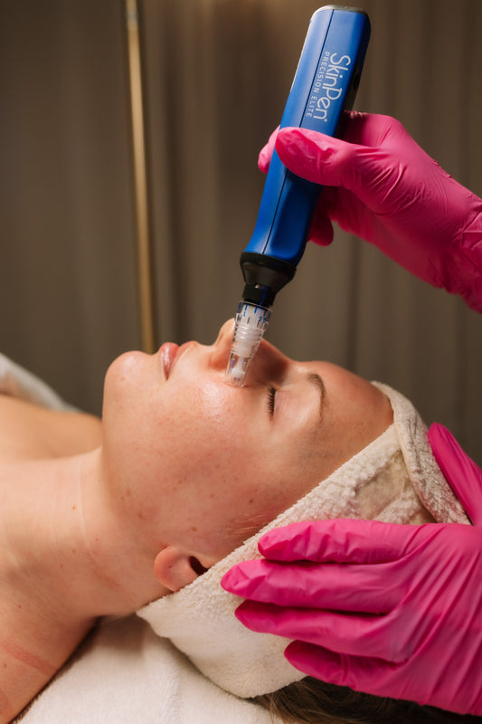 Microneedling in Andover, KS – What to Expect and Where to Book